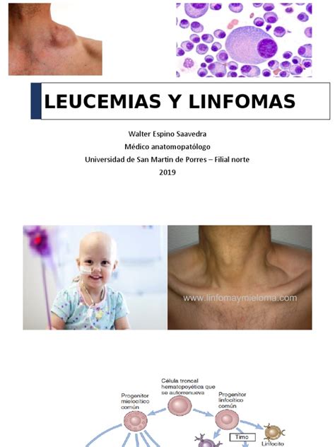A Leucemia Linfoma Black Tie Black Jack
